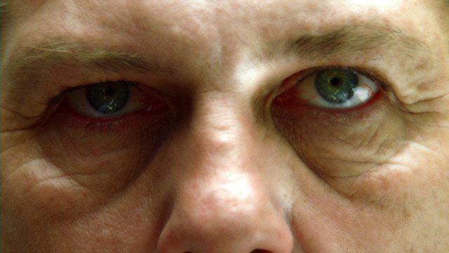 Dr. House S03E01