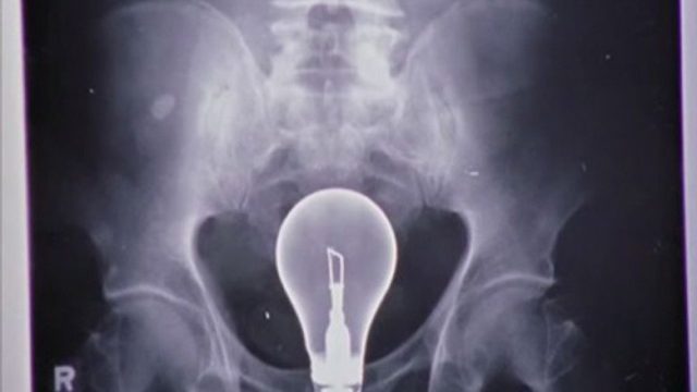Scrubs S04E02